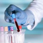 What Do Blood Test Results Mean?
