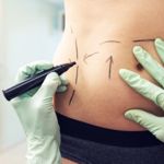 The Most Popular Plastic Surgery Procedures