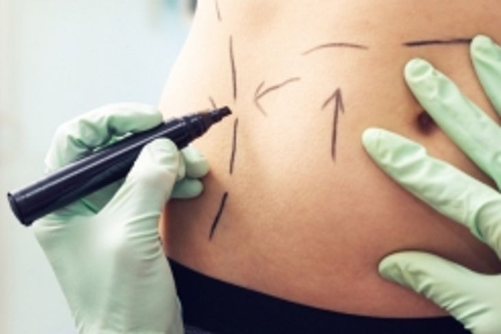 The Most Popular Plastic Surgery Procedures