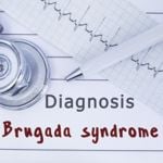 Understanding More About Brugada Syndrome