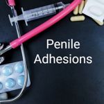 Penile Adhesions: Causes, Treatment, and Prevention