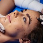 Benefits and Side Effects of Plastic Surgery