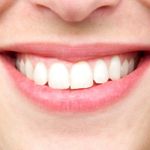 Receding Gums: Causes, Treatments, and Tips for Prevention