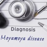 What is Moyamoya Disease?