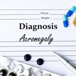 What is Acromegaly?