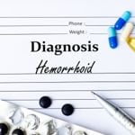 Hemorrhoids — 10 Symptoms To Watch For