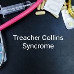 What is Treacher Collins Syndrome?