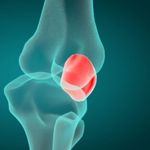 The Patella: Support for the Whole Body