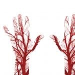 What is the Radial Artery?