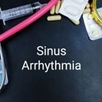 What are Sinus Arrhythmias?