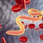 All About Blastocystis Hominis