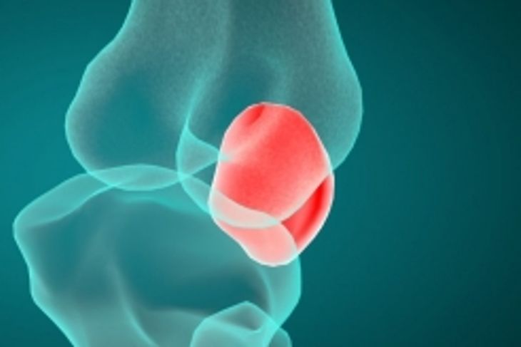 The Patella: Support for the Whole Body