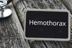What is Hemothorax?