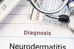 What is Neurodermatitis?