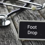 What Is Foot Drop?