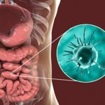 Parasitic Infections: 10 Symptoms You Can't Ignore