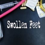 Understanding and Managing Swollen Feet