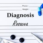10 Symptoms of Rosacea