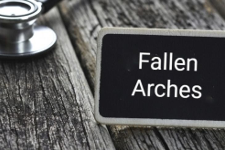 All About Fallen Arches