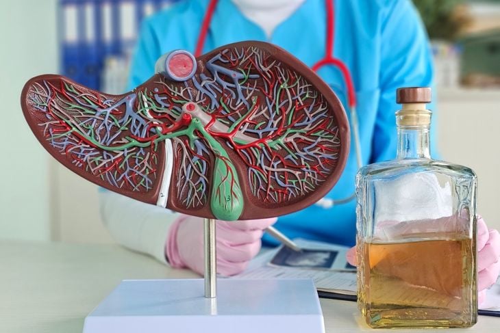 Alcoholic liver damage and liver cirrhosis concept