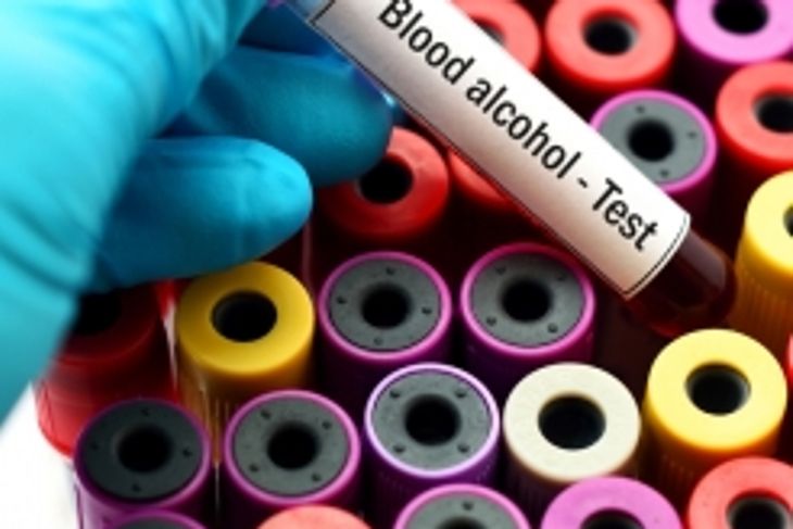 How Long Does Alcohol Stay in Your Body?