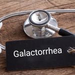 10 Things You Need To Know About Galactorrhea