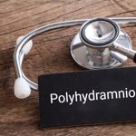 Polyhydramnios: Excessive Accumulation of Amniotic Fluid