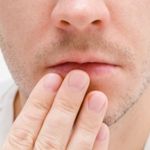 Can These 10 Home Remedies Help Clear Cold Sores?