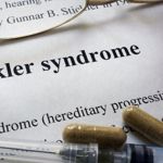 What is Stickler Syndrome?