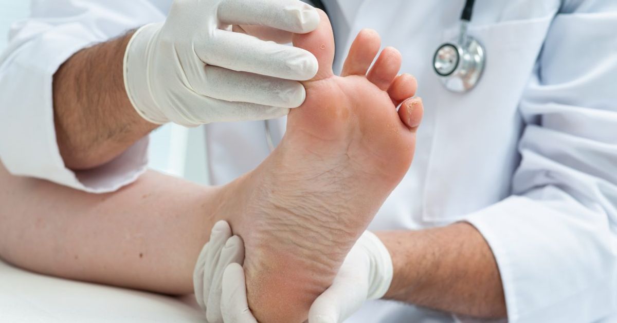 How to Fix an Ingrown Toenail Facty