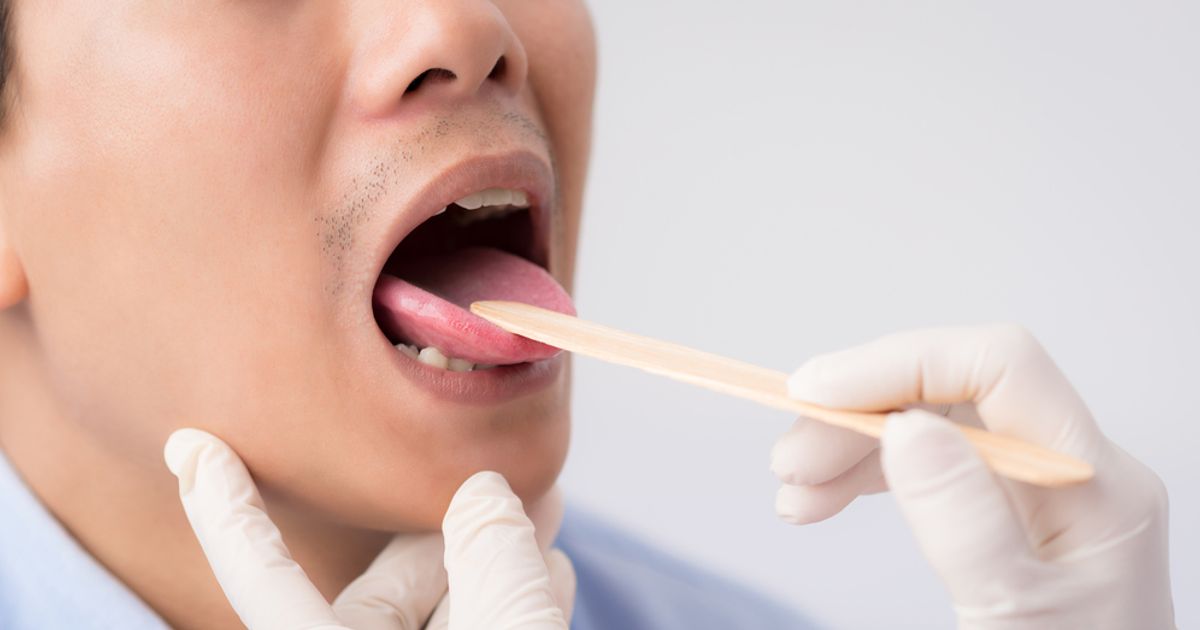 What Causes a Yellow Tongue? Facty Health