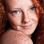 Red Hair, Freckles, and Other Benefits of Being a Ginger
