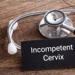 What Is Cervical Insufficiency or Incompetent Cervix?