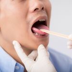 What Causes a Yellow Tongue?