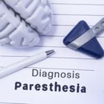 Causes and Treatment of Paresthesia