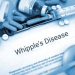 A Bacterial Infection Leads to Whipple's Disease
