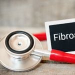 What You Should Know About Non-Cancerous Fibroadenoma