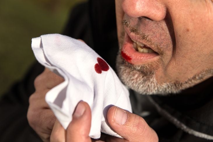 What Are the Causes of Coughing Up Blood?
