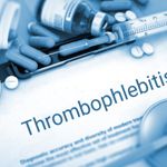 Causes, Signs, and Treatments of Thrombophlebitis
