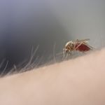 Severe Mosquito Bites: Skeeter Syndrome