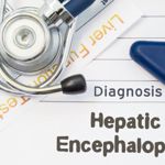 Advanced Liver Disease Leads to Hepatic Encephalopathy