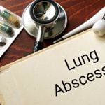 The Causes, Symptoms, and Treatments for Lung Abscesses
