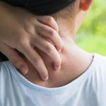 What You Need to Know About Swimmer's Itch