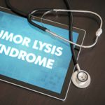 Symptoms, Prevention, and Treatment of Tumor Lysis Syndrome