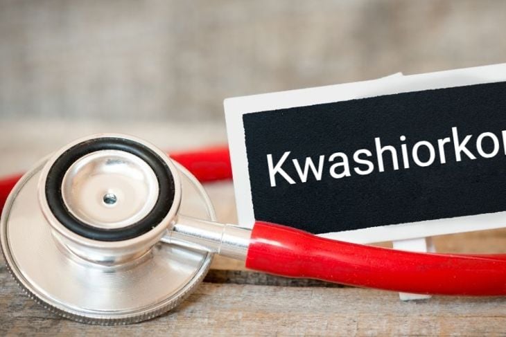 Protein Malnutrition Leading to Kwashiorkor