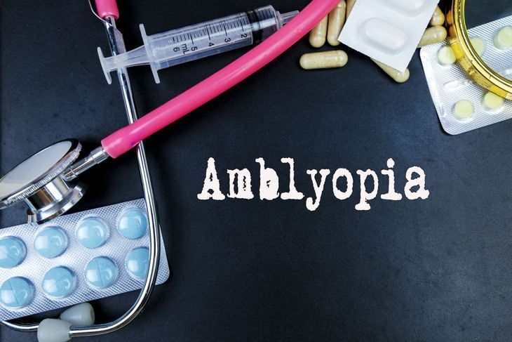 The Development and Effects of Amblyopia or Lazy Eye