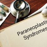 What Are Paraneoplastic Syndromes and How Are They Managed?