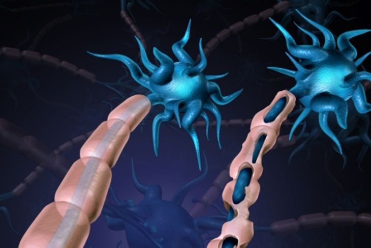 Causes and Effects of Demyelination