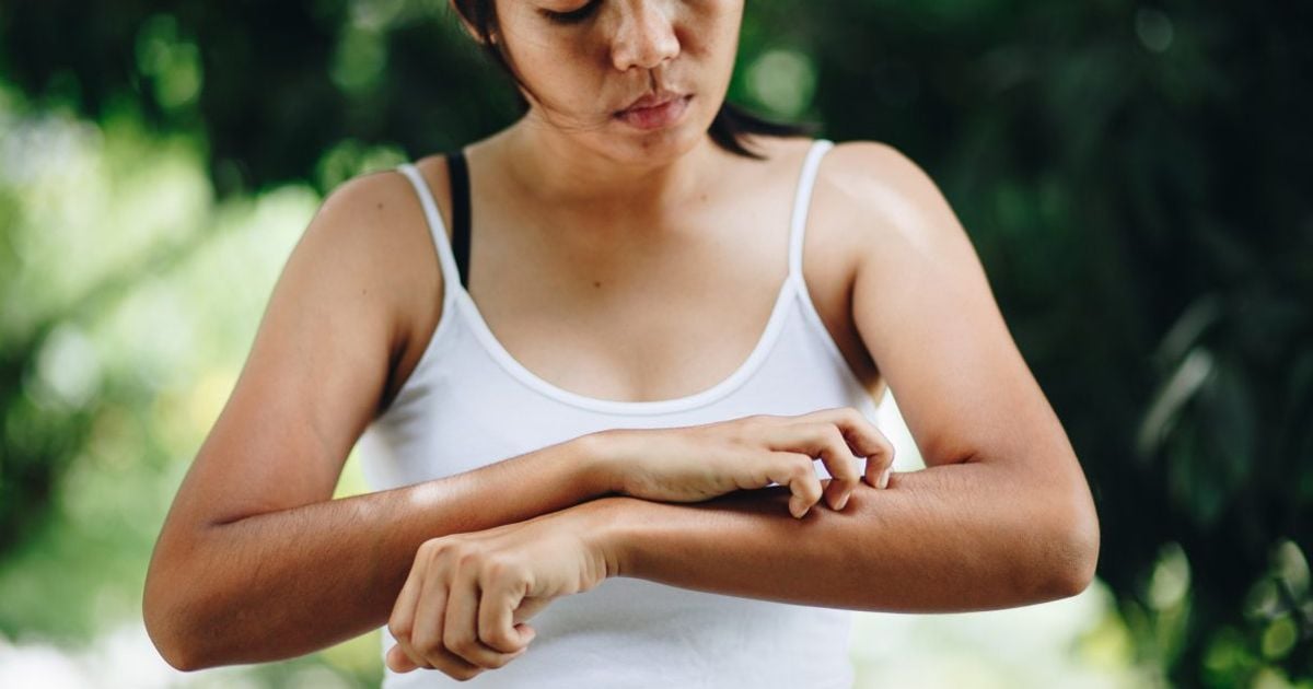 What Is SkinPicking or Excoriation Disorder? Facty Health