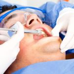 What You Need to Know About Root Canals